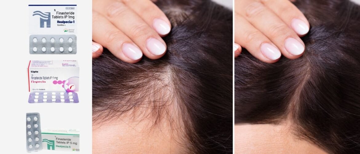 Everything You Should Know Before Taking Finasteride